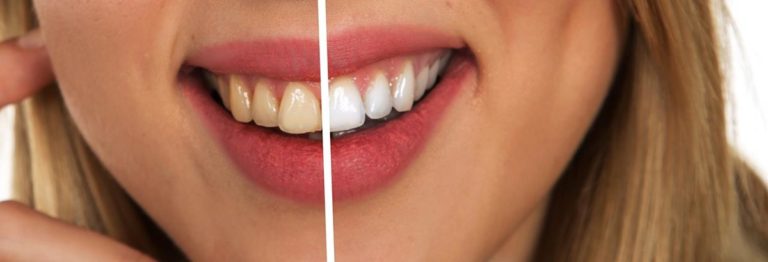 Fachowa chirurgia dentystyczna i jej atuty